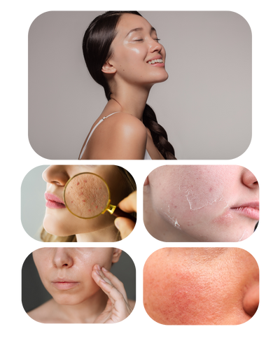 Oily Skin, Dry Skin, Redness and sensitive skin